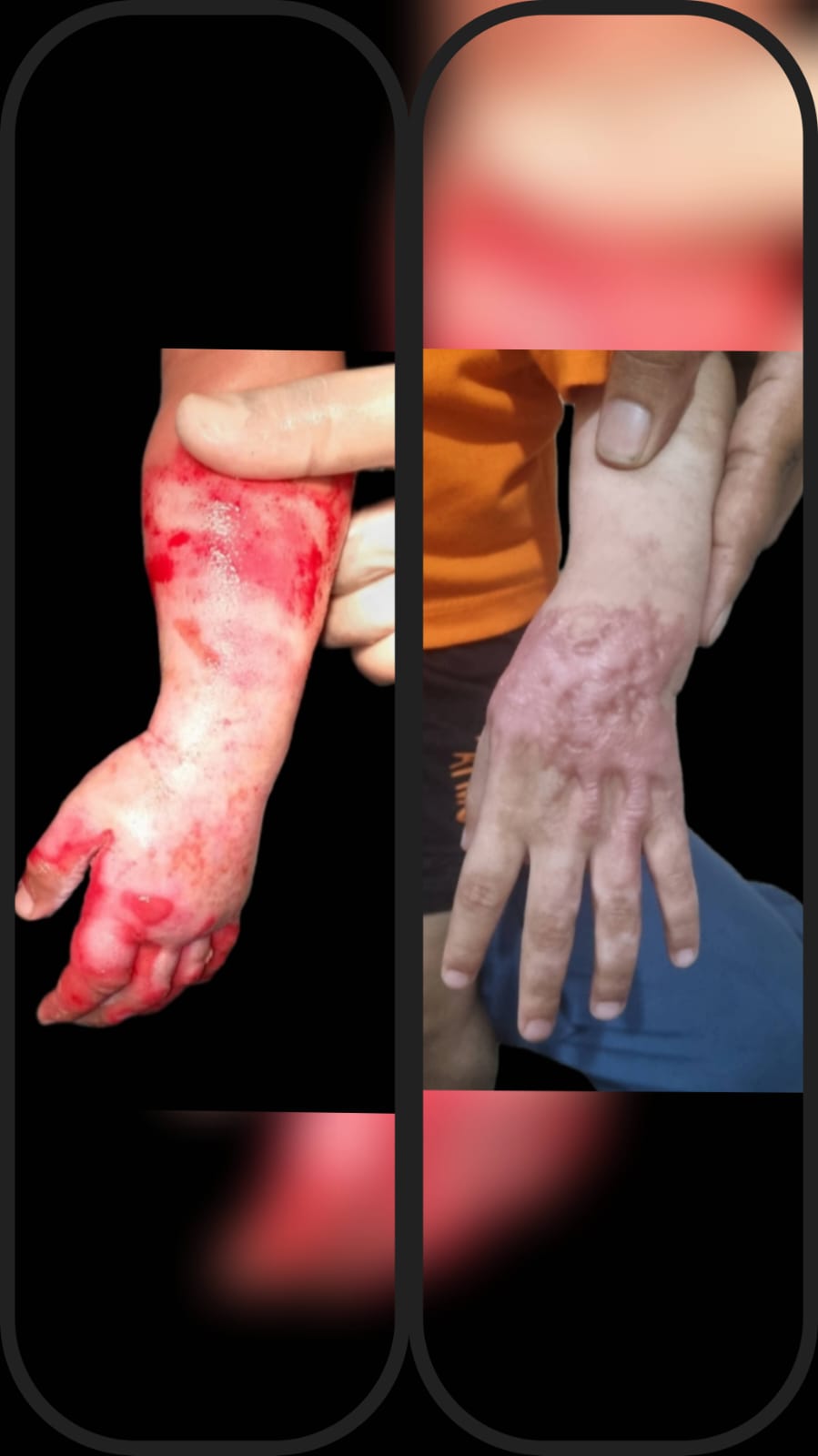 Before & After 40